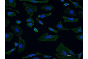 Immunofluorescence of monoclonal antibody to SH3GL1 on HeLa cell.