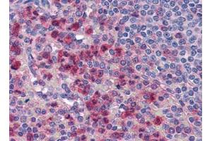 Image no. 1 for anti-Interleukin-27 Subunit alpha (IL27) (Center) antibody (ABIN372920) (IL27 anticorps  (Center))
