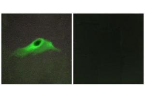 Immunofluorescence (IF) image for anti-Collagen, Type IV, alpha 5 (COL4A5) (N-Term) antibody (ABIN1850286) (COL4a5 anticorps  (N-Term))