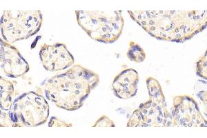 Detection of IL1RL1 in Human Placenta Tissue using Polyclonal Antibody to Interleukin 1 Receptor Like Protein 1 (IL1RL1) (IL1RL1 anticorps  (AA 162-349))