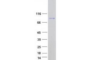 Validation with Western Blot