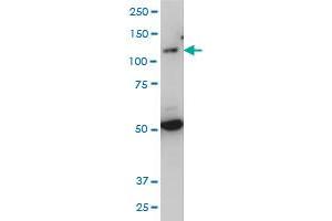 TLR7 monoclonal antibody (M04), clone 2C9 Western Blot analysis of TLR7 expression in IMR-32 .