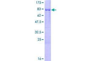Image no. 1 for Caspase Recruitment Domain Family, Member 9 (CARD9) (AA 1-492) protein (GST tag) (ABIN1348063)