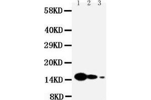 Anti-IL7 antibody, Western blotting Lane 1: Recombinant Mouse IL-7 Protein 10ng Lane 2: Recombinant Mouse IL-7 Protein 5ng Lane 3: Recombinant Mouse IL-7 Protein 2. (IL-7 anticorps  (N-Term))