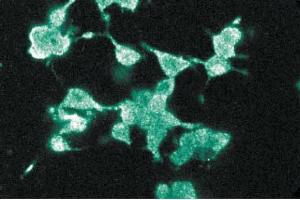 Immunofluorescence staining of PC12 cells (Rat neuroblastoma, ATCC CRL-1721). (DLG4 anticorps  (AA 353-504))