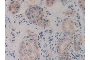 Detection of Slit1 in Human Stomach Tissue using Polyclonal Antibody to Slit Homolog 1 (Slit1)