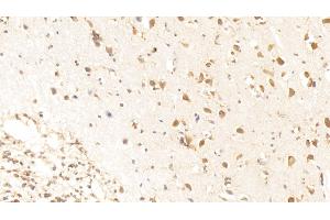 Detection of MST1R in Human Cerebrum Tissue using Polyclonal Antibody to Macrophage Stimulating 1 Receptor (MST1R)