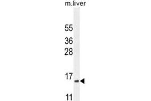 Western Blotting (WB) image for anti-Complexin 3 (CPLX3) antibody (ABIN2995755) (CPLX3 anticorps)
