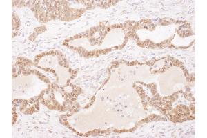 Immunohistochemistry (IHC) image for anti-Glutathione S-Transferase pi 1 (GSTP1) (AA 160-210) antibody (ABIN7453941)