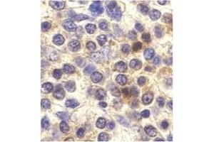 Image no. 1 for anti-Chemokine (C-X3-C Motif) Receptor 1 (CX3CR1) antibody (ABIN203578) (CX3CR1 anticorps)
