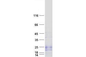 Validation with Western Blot