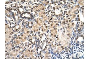 ANP32E antibody was used for immunohistochemistry at a concentration of 4-8 ug/ml. (ANP32E anticorps)