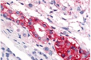 Anti-CRF1 antibody  ABIN1048462 IHC staining of human pituitary.