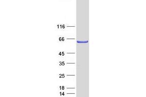 Validation with Western Blot
