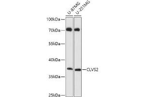 Western blot analysis of extracts of various cell lines, using CLVS2 antibody (ABIN7266410) at 1:1000 dilution.