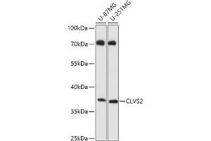 Western blot analysis of extracts of various cell lines, using CLVS2 antibody (ABIN7266410) at 1:1000 dilution. (CLVS2 anticorps  (AA 265-327))