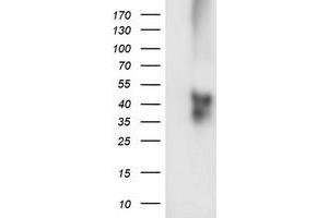 Western Blotting (WB) image for anti-Transmembrane Protein with EGF-Like and Two Follistatin-Like Domains 2 (TMEFF2) antibody (ABIN1501418) (TMEFF2 anticorps)
