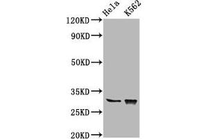 Western Blot Positive WB detected in: Hela whole cell lysate, K562 whole cell lysate All lanes: CHODL antibody at 6. (CHODL anticorps  (AA 105-206))