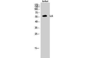 Western Blotting (WB) image for anti-Lymphocyte-Specific Protein tyrosine Kinase (LCK) (Ser736) antibody (ABIN3180146) (LCK anticorps  (Ser736))