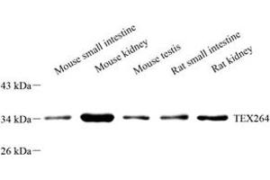 Western blot analysis of TEX264 (ABIN7075863) at dilution of 1: 2000 (TEX264 anticorps)