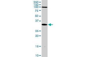 DLX3 MaxPab rabbit polyclonal antibody.