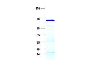 Validation with Western Blot