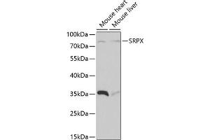 Western blot analysis of extracts of various cell lines, using SRPX antibody  at 1:1000 dilution. (SRPX anticorps  (AA 40-320))