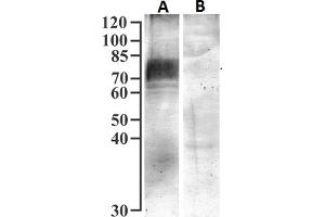 ABIN7013885 (1 μg/mL) staining of isolated Brush Border Membranes from Human Kidney (75 μg protein) with (B) and without (A) blocking with the immunizing peptide.