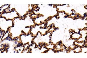 Detection of ACE in Mouse Lung Tissue using Polyclonal Antibody to Angiotensin I Converting Enzyme (ACE)
