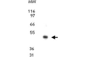 Western blot analysis for CCR10. (CCR10 anticorps  (AA 350-362))
