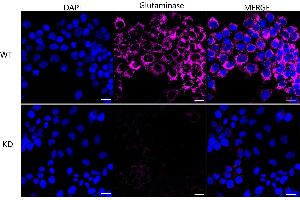Immunocytochemical staining of HeLa cells using Glutaminase antibody (ABIN7798747), 1:1,000), Top panel: wild-type (WT), Bottom panal: Glutaminase shRNA knockdown (KD).