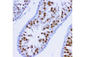 Anti- MCAK antibody, IHC(P) IHC(P): Rat Testis Tissue