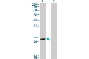 Western Blot analysis of RCV1 expression in transfected 293T cell line by RCV1 monoclonal antibody (M14), clone 1B7. (Recoverin anticorps  (AA 101-199))