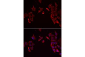 Immunofluorescence analysis of MCF-7 cell using RAMP3 antibody. (RAMP3 anticorps)