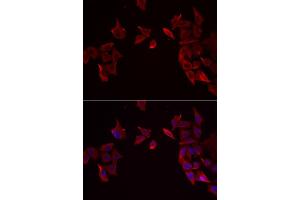 Immunofluorescence analysis of MCF-7 cell using RAMP3 antibody.