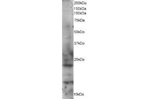 ABIN184568 staining (1µg/ml) of HeLa lysate (RIPA buffer, 35µg total protein per lane). (RAB2A anticorps  (C-Term))