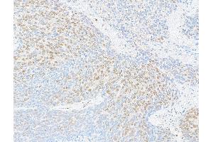 Immunohistochemistry (IHC) image for anti-RNA Binding Motif Protein 9 (RBM9) (AA 1-50) antibody (ABIN7454680)