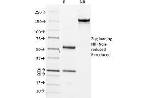 SDS-PAGE Analysis Purified CDC20 Mouse Monoclonal Antibody (AR12). (CDC20 anticorps)