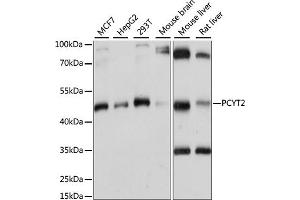 Western blot analysis of extracts of various cell lines, using PCYT2 antibody (ABIN7269277) at 1:1000 dilution. (PCYT2 anticorps  (AA 1-389))