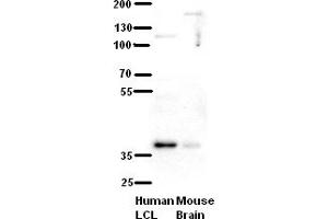 WB Suggested Anti-C21orf59 Antibody Titration:  5% Milk  ELISA Titer:  dilution: 1:500  Positive Control:  human LCL and mouse brains (C21orf59 anticorps  (N-Term))