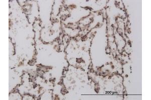 Immunoperoxidase of monoclonal antibody to FOXL1 on formalin-fixed paraffin-embedded human lung. (FOXL1 anticorps  (AA 132-240))