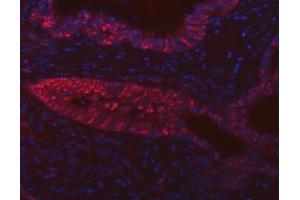 anti-FIP1 Like 1 (FIP1L1) (AA 23-558) antibody