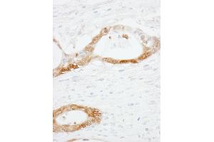 Immunohistochemistry (IHC) image for anti-Cellular Retinoic Acid Binding Protein 2 (CRABP2) (C-Term) antibody (ABIN7454522) (CRABP2 anticorps  (C-Term))