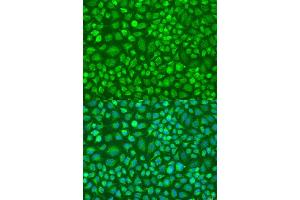 Immunofluorescence analysis of U2OS cells using DN antibody (ABIN6127820, ABIN6139729, ABIN6139731 and ABIN6224283) at dilution of 1:100.