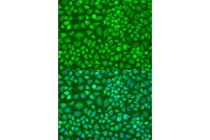 Immunofluorescence analysis of U2OS cells using DN antibody (ABIN6127820, ABIN6139729, ABIN6139731 and ABIN6224283) at dilution of 1:100. (DNAL1 anticorps  (AA 41-190))