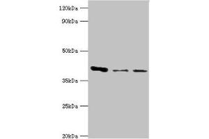 Western blot All lanes: E3 Ribonucleoside-diphosphate reductase subunit M2 B antibody at 6 μg/mL Lane 1: MCF-7 whole cell lysate Lane 2: Hela whole cell lysate Lane 3: HepG2 whole cell lysate Secondary Goat polyclonal to rabbit IgG at 1/10000 dilution Predicted band size: 41, 35, 16, 8, 5, 49 kDa Observed band size: 41 kDa (RRM2B anticorps  (AA 1-351))