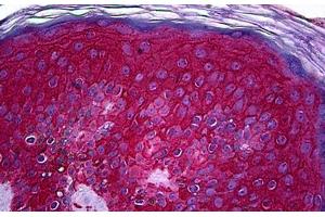 Human Skin: Formalin-Fixed, Paraffin-Embedded (FFPE) (KIT anticorps  (AA 41-140))