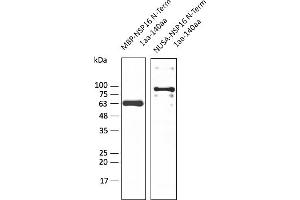 Western Blotting (WB) image for anti-SARS-CoV-2 2'-O-Ribose Methyltransferase (NSP16) (N-Term) antibody (ABIN7273008) (SARS-CoV-2 NSP16 anticorps  (N-Term))