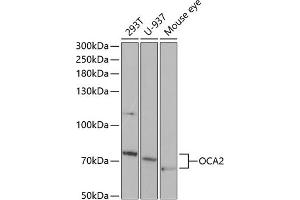 Western blot analysis of extracts of various cell lines, using OC antibody (ABIN6132880, ABIN6144989, ABIN6144990 and ABIN6221296) at 1:1000 dilution. (OCA2 anticorps  (AA 1-180))