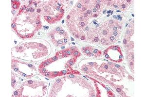 Anti-CADM4 / NECL-4 antibody IHC of human kidney.